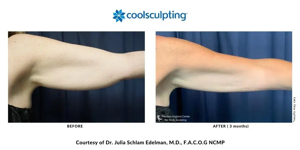 439654434-julia-edelman-before-and-after-mobile-11 439654434-julia-edelman-before-and-after-mobile-11