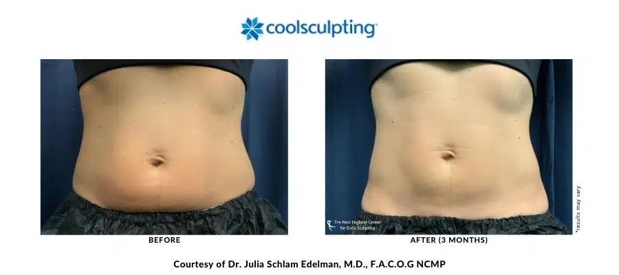 439660273-dr-julia-edelman-before-and-after-desktop-900px-400px-900-x-700-px-900-x-400-px-15 439660273-dr-julia-edelman-before-and-after-desktop-900px-400px-900-x-700-px-900-x-400-px-15