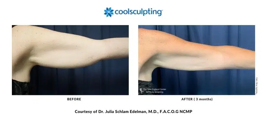 439660289-dr-julia-edelman-before-and-after-desktop-900px-400px-900-x-700-px-900-x-400-px-14 439660289-dr-julia-edelman-before-and-after-desktop-900px-400px-900-x-700-px-900-x-400-px-14