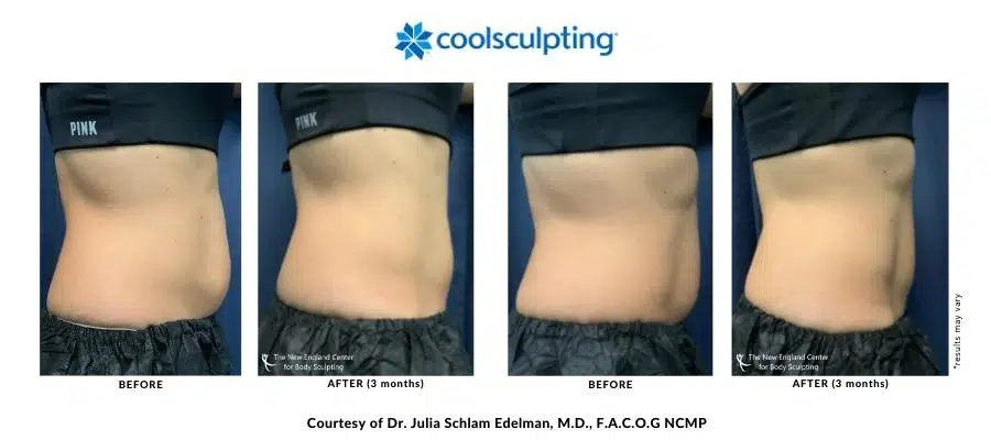 439660351-dr-julia-edelman-before-and-after-desktop-900px-400px-900-x-700-px-900-x-400-px-11 439660351-dr-julia-edelman-before-and-after-desktop-900px-400px-900-x-700-px-900-x-400-px-11