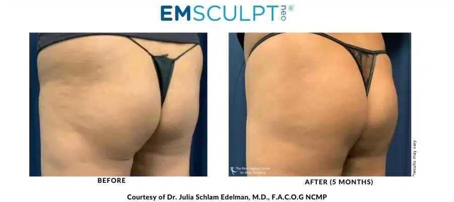 dr.-julia-edelman-before-and-after-desktop900px-400px-900–700-px-900–400-px-17-1 dr.-julia-edelman-before-and-after-desktop900px-400px-900–700-px-900–400-px-17-1