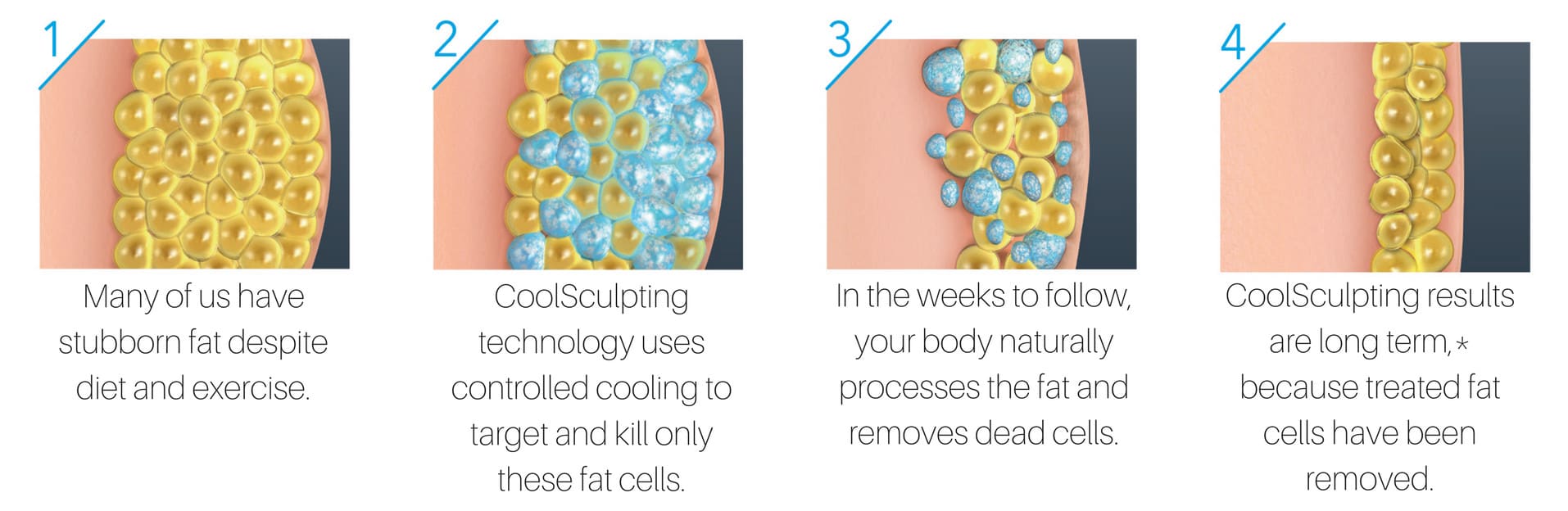 how-coolsculpting-works-web how-coolsculpting-works-web