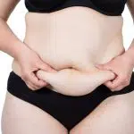 coolsculpting cost