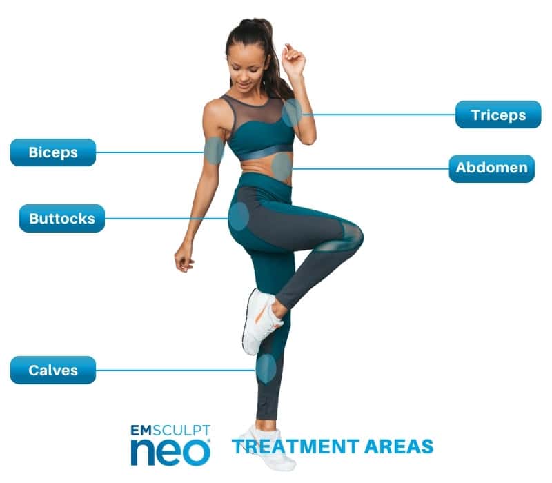 emsculpt-neo-treatment-areas emsculpt-neo-treatment-areas