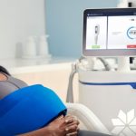 Woman undergoing CoolSculpting body contouring treatment while sitting comfortably beside a medical device monitor in a clinic setting.
